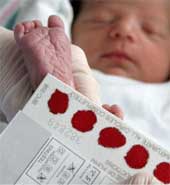 آزمایش خون نوزاد