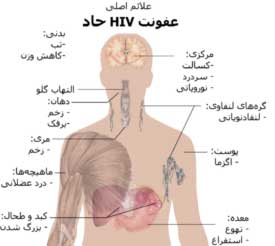 بیماری ایدز HIV