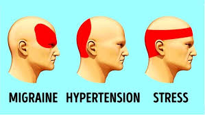 نقاط مختلف درد در سر